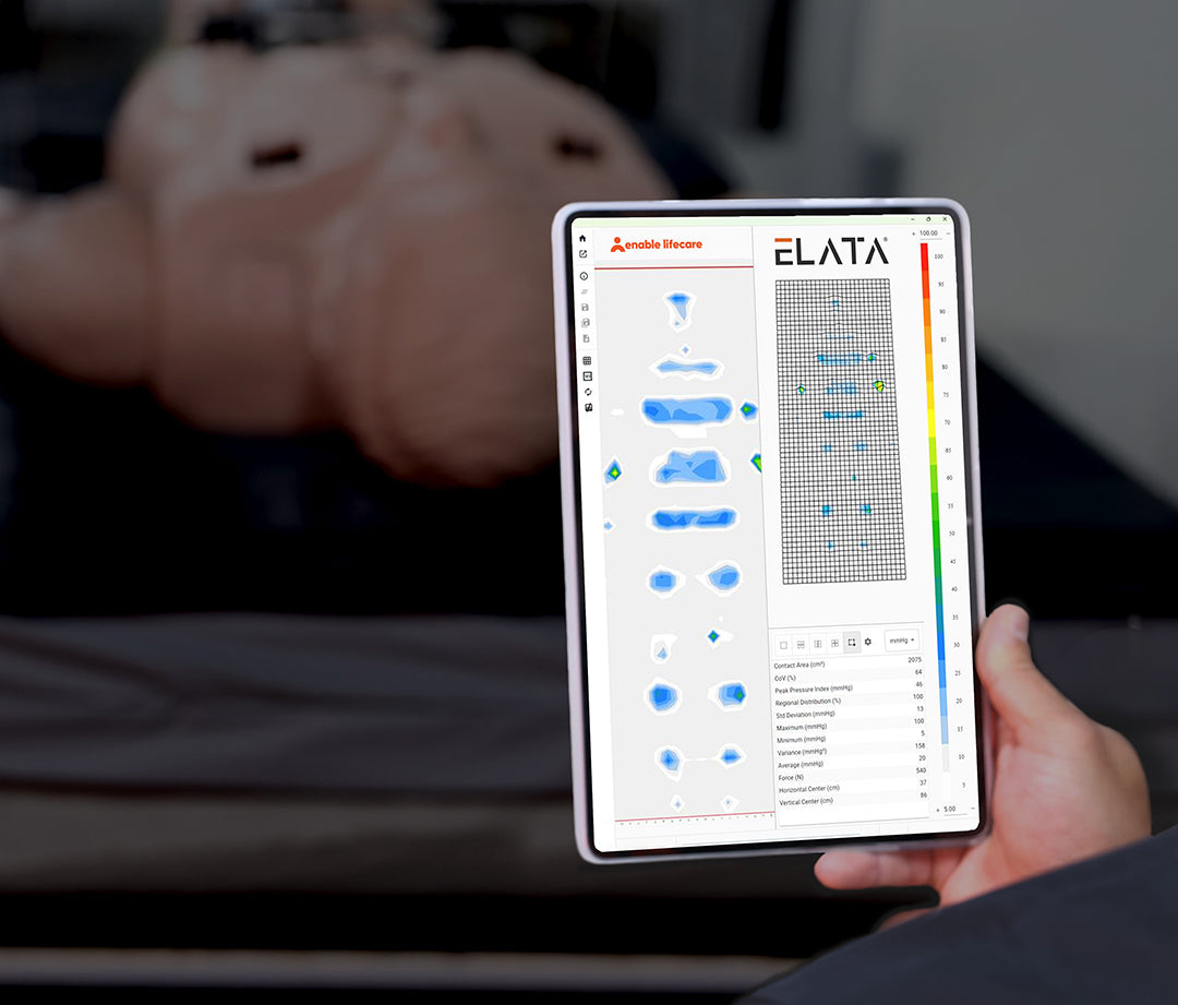 Comparing Pressure Care Mattresses Using Pressure Mapping in Clinical Practice